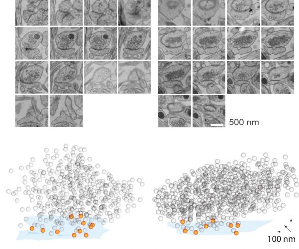 EM reconstruction